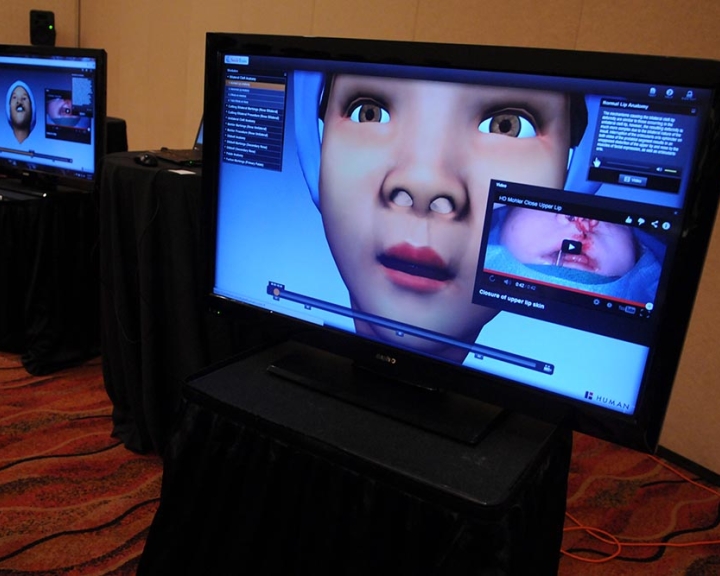 Smile Train Virtual Surgery Simulator